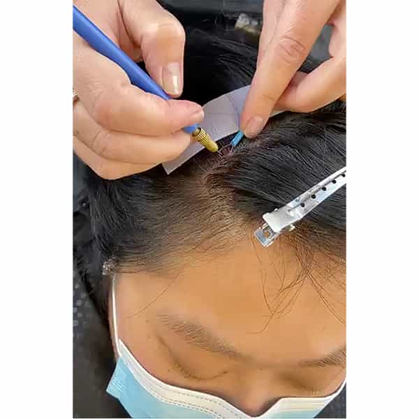 micro-point-links